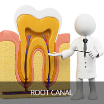 root canal in pasadena