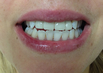 Pasadena Dentist, Cosmetic Dentistry, Invisalign Orthodontics 91105